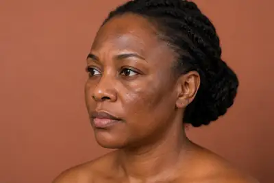 Middle-aged Black woman with hyperpigmentation on face