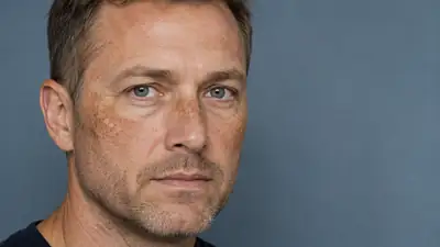 Middle-aged man with facial hyperpigmentation and sunspots
