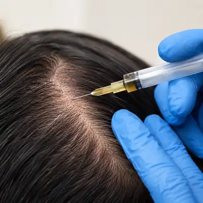 Scalp Injection Detail Extreme Close Up for Hair Treatment