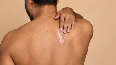 Man Applying Moisturizing Cream on His Back - Clinical Dermatology Stock Photo