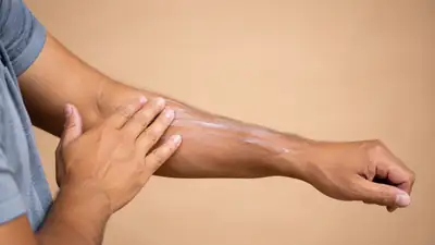 Applying Sunscreen Lotion on Arm - Healthcare and Skincare Stock Photo