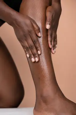 Applying Sun Protection Lotion on Leg - Clinical Skincare Photo