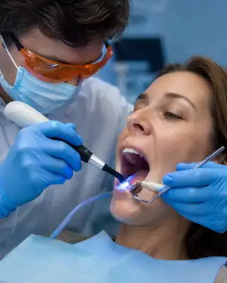 Dentist Using Composite Light Curing Tool on Patient Teeth