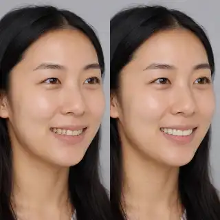 Before and After Natural Veneer Smile Dental Transformation Stock Photo