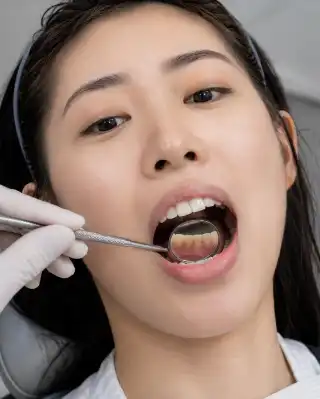 Front Tooth Inspection and Dental Examination by Dentist - Clinical Photo