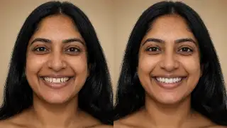 Complete Smile Makeover Before and After Dental Treatment Photo