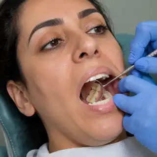 Dentist Checking Molars with Dental Mirror During Clinical Examination