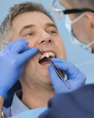 Dentist Fitting Front Tooth Crown on Male Patient in Clinic
