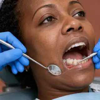 Dental Crown Cementation Procedure in Clinical Setting - Stock Photo