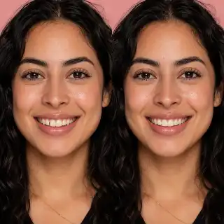 Before and After Peg Lateral Bonding Cosmetic Dentistry Stock Photo