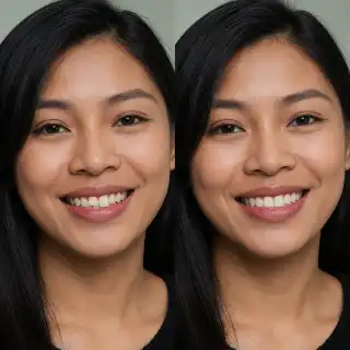 Dental Diastema Closure Before and After Teeth Whitening and Correction