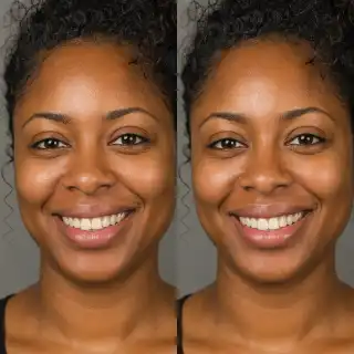 Minor Tooth Reshaping Before and After Dental Treatment Photo