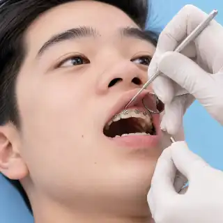 Dentist Changing Ligatures on Young Male Patient Braces - Dental Care Photo