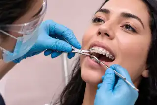 Orthodontist Adjusting Ceramic Braces on Patient Teeth - Dental Stock Photo