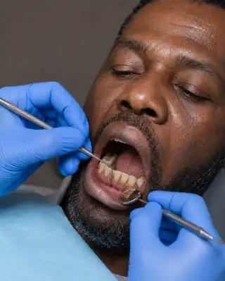 Periodontitis Assessment by Dentist Using Dental Probe and Mirror Stock Photo