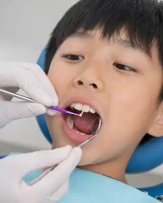 Pediatric Dentist Applying Fluoride Varnish On Child Teeth - Stock Photo